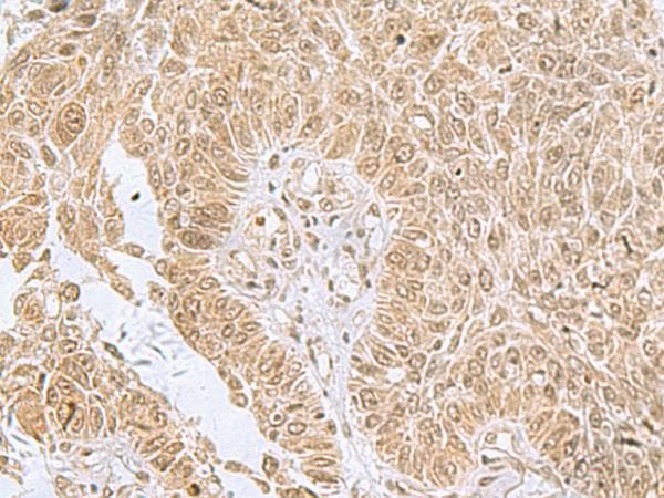 PHF6 Antibody