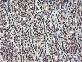 ZBED1 / TRAMP Antibody (clone OTI5A2)