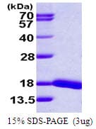 Human UBE2D4 Protein (Recombinant His)