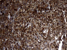 NME1 / NM23 Antibody (clone OTI1A12)