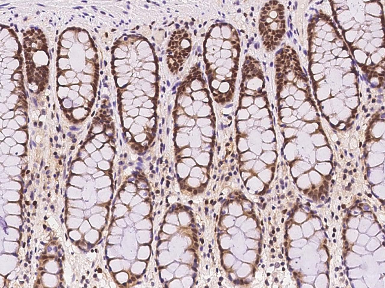FKBP5 / FKBP51 Antibody