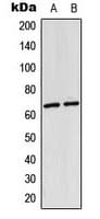 RELA / NFKB p65 Antibody (Acetyl-Lys310)