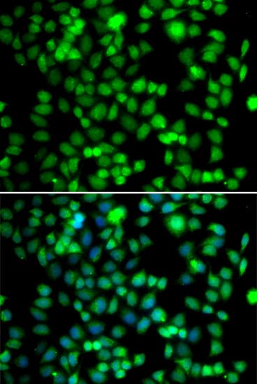 FKBP6 Antibody