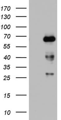 Monoclonal Mouse anti-Human NUMB Antibody (clone OTI3H8, aa1-365, IHC, WB)