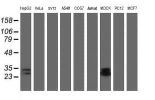 RBPMS / Hermes Antibody (clone OTI3B7)