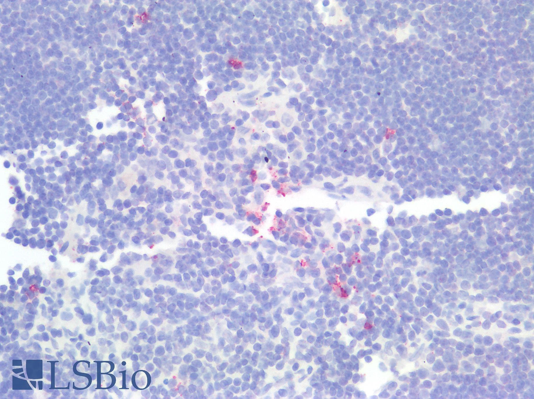 PathPlus™ Monoclonal Mouse anti-Human LAG3 Antibody (clone 9F9, IHC, IF)