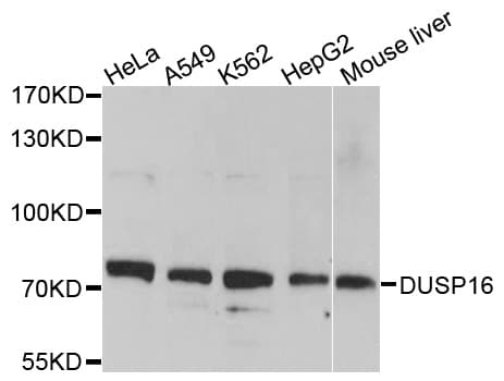Polyclonal Rabbit anti-Human DUSP16 / MKP7 Antibody (WB)