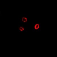GPI Antibody
