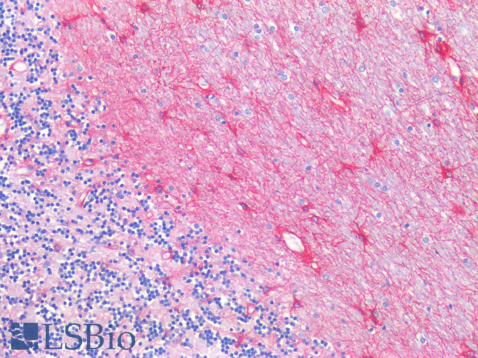 PathPlus™ Polyclonal Rabbit anti-Human GFAP Antibody (IHC)