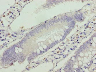 VPS25 Antibody