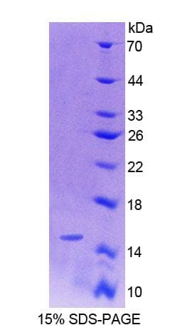 Rat Oxytocin Protein (Recombinant His-T7, N-terminus)