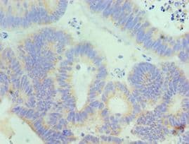 AcPL / IL18RAP Antibody (aa390-599)