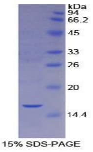 Human CASP2 / Caspase 2 Protein (Recombinant His)