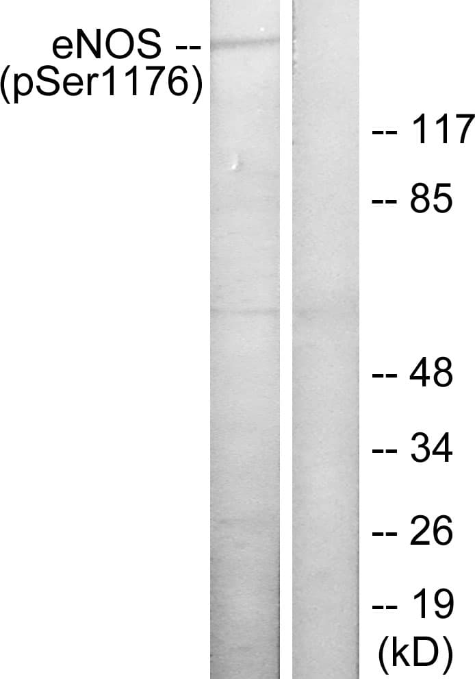 NOS3 / eNOS Antibody (phospho-Ser1176)