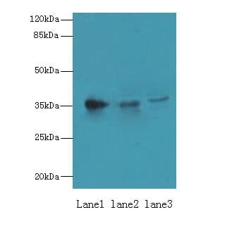Polyclonal Rabbit anti-Human UP2 / UPP2 Antibody (WB)