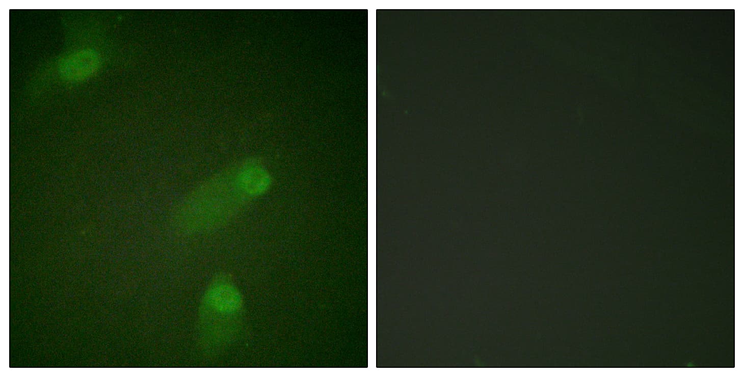 NFKB1 / NF-Kappa-B Antibody (aa896-945)