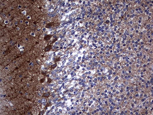 Monoclonal Mouse anti-Human NUMB Antibody (clone OTI3H8, aa1-365, IHC, WB)