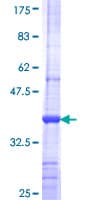 Human MOK / RAGE Protein (Recombinant GST)