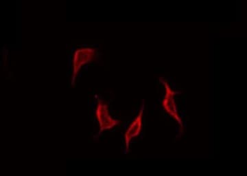 Polyclonal Rabbit anti-Human MMP9 / Gelatinase B Antibody (IHC, IF, WB)