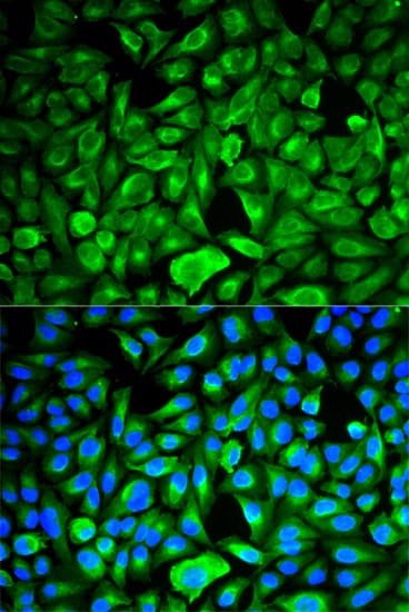 PEBP1 / RKIP Antibody