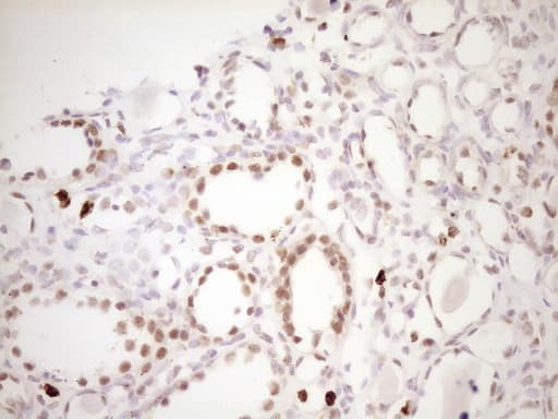 Monoclonal Mouse anti-Human TFPI / LACI Antibody (clone OTI5H5, Carrier-free, aa29-304, IHC, WB)
