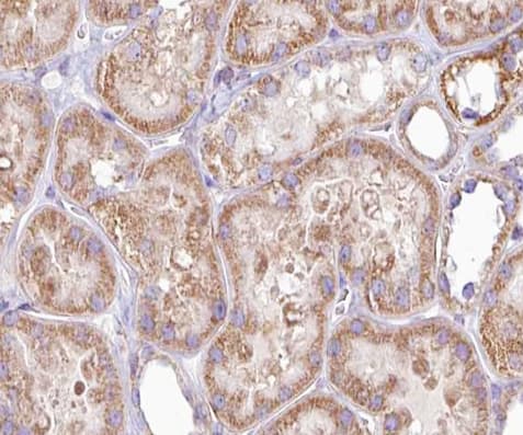 DGKeta / DGKH Antibody