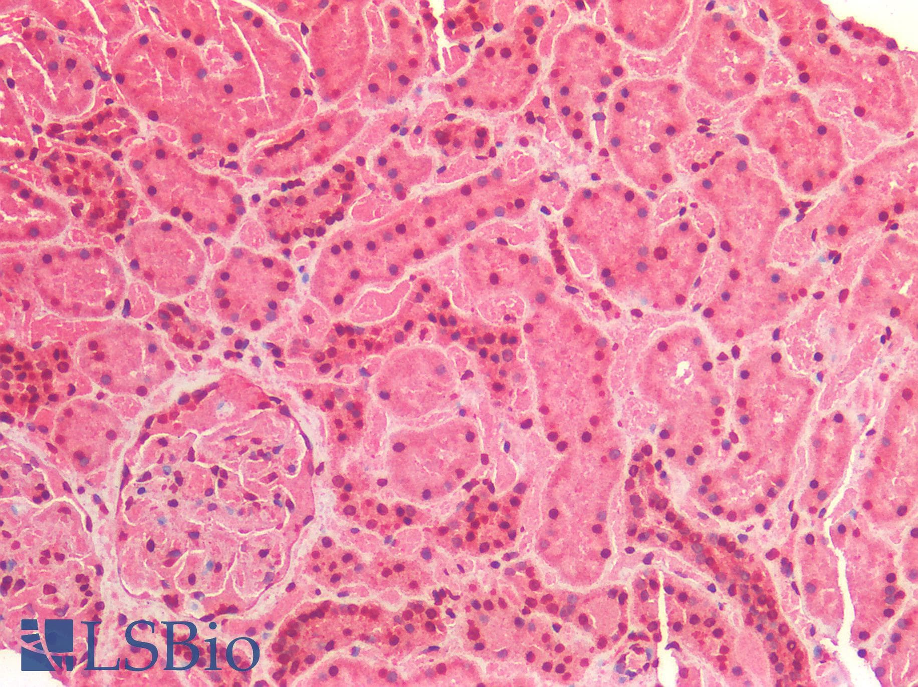 IHC-plus™ Polyclonal Rabbit anti-Human IGF1R / IGF1 Receptor Antibody (IHC)