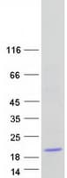 Human FAM136B Protein (Recombinant Myc-DDK (Flag))