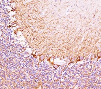 NEFH / NF-H Antibody (clone RT97)