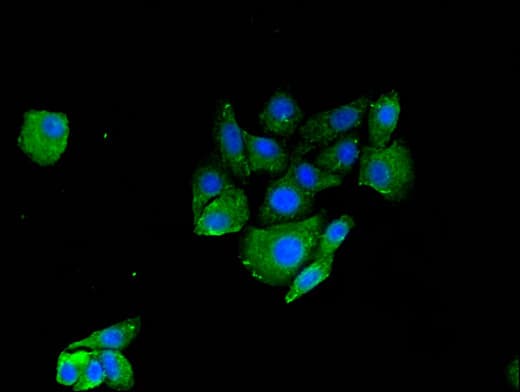 RNF126 Antibody (aa39-225)
