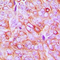 Polyclonal Rabbit anti-Human ITGB3 / Integrin Beta 3 / CD61 Antibody (phospho-Tyr773, IHC, WB)