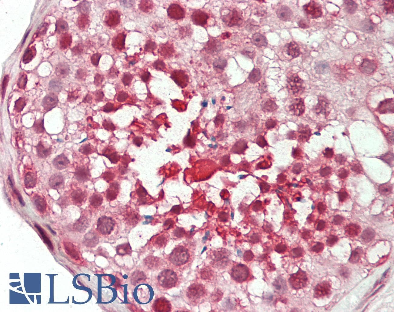 IHC-plus™ MICAL1 / MICAL Antibody (clone 2H1)