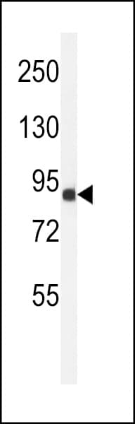 Polyclonal Rabbit anti-Human ANKRD49 Antibody (aa80-109, IHC, WB)