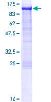 Human CYPOR / POR Protein (Recombinant GST)