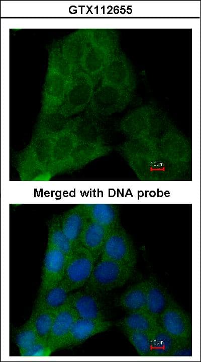 PTGES3 / p23 Antibody
