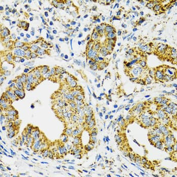Polyclonal Rabbit anti-Human HSPA9 / Mortalin / GRP75 Antibody (IHC, IF, WB)