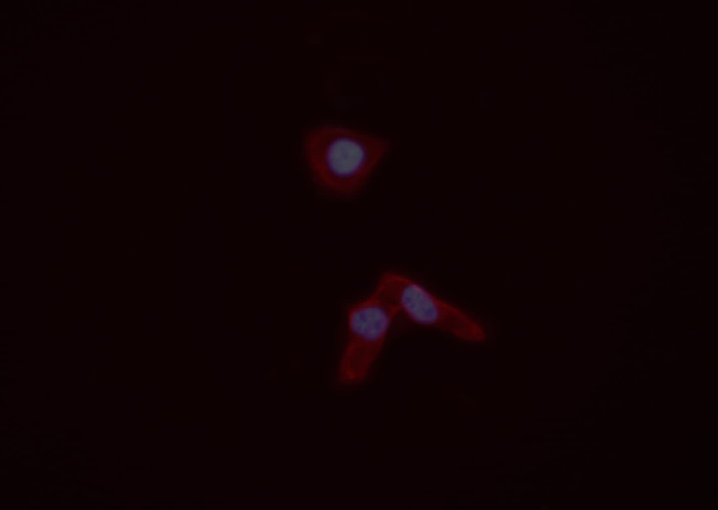 S100A4 / FSP1 Antibody