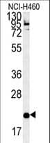 SLAMF7 / CRACC Antibody (aa58-85)