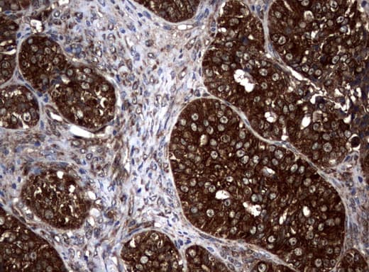 NME1 / NM23 Antibody (clone UMAB91)