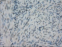 STK39 / SPAK Antibody (clone OTI3C12)