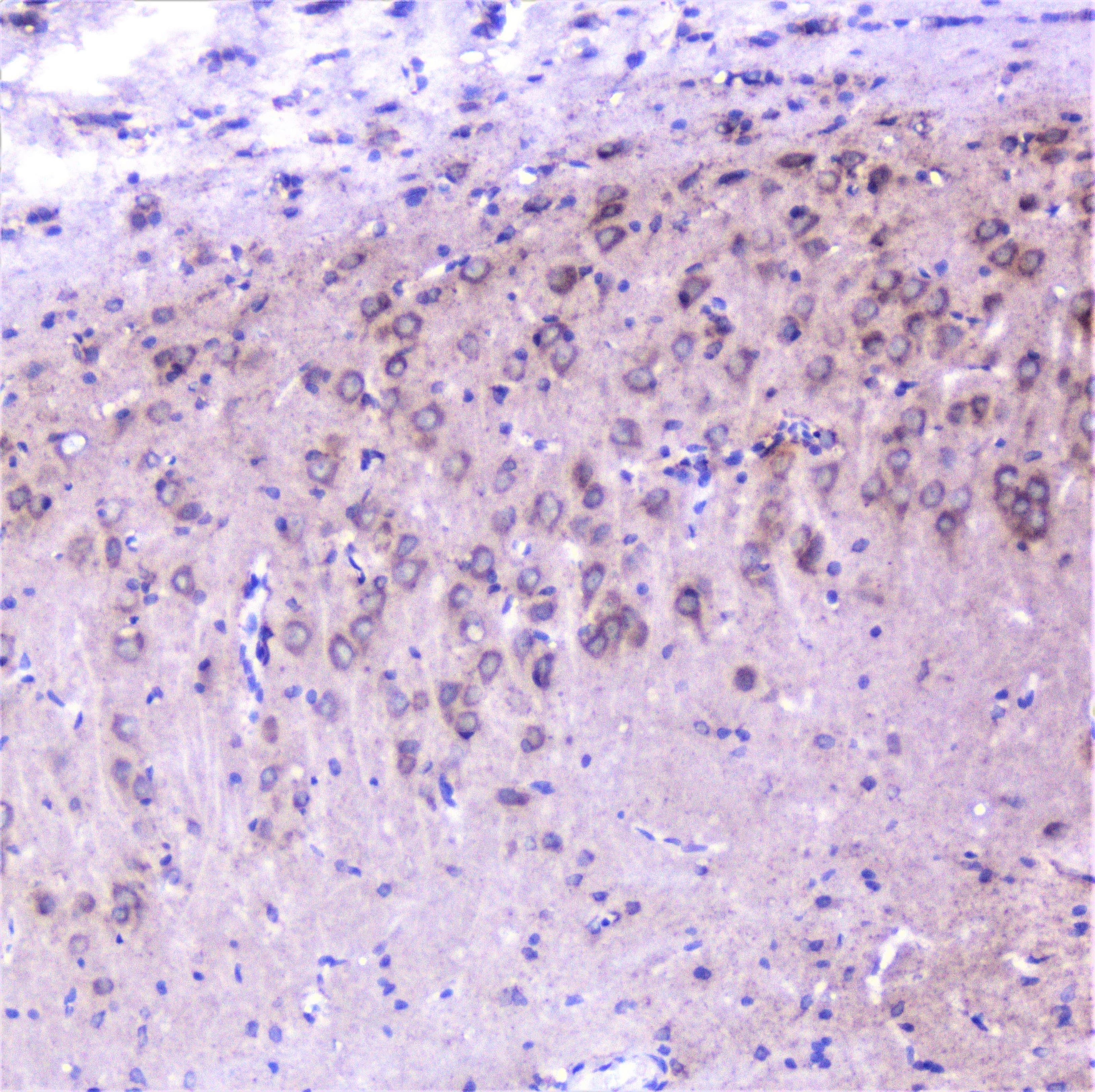 CTTN / Cortactin Antibody