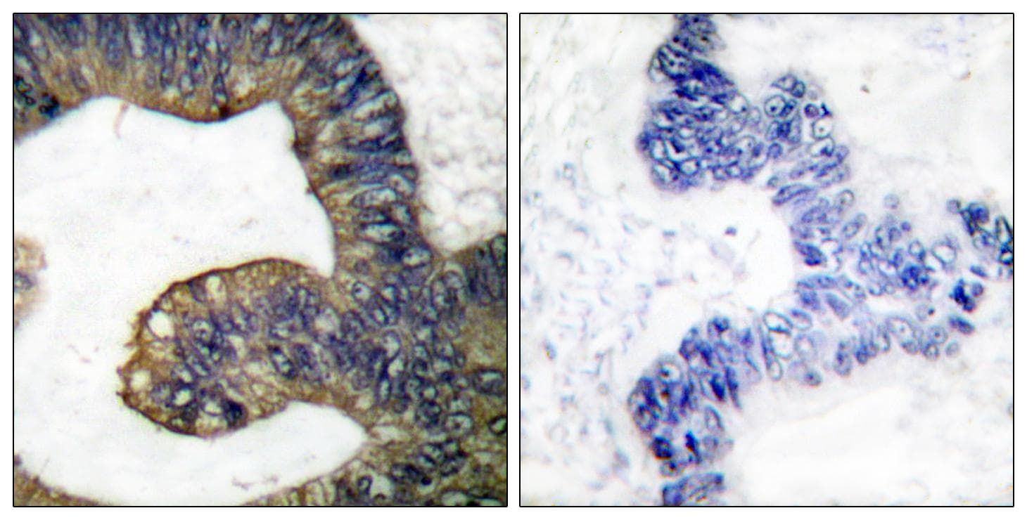 PLA2G4A Antibody (p505)