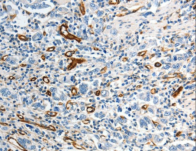 ABCG1 Antibody