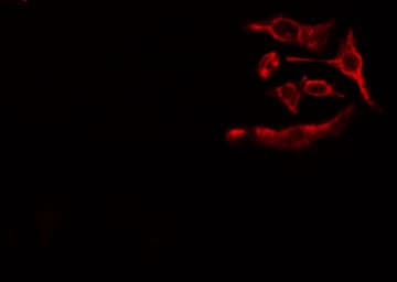 ZAP70 Antibody (phospho-Tyr493)