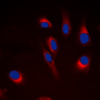 CYP21A2 Antibody (Internal)