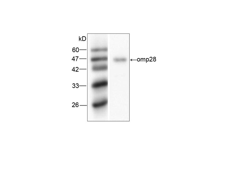 Legionella pneumophila omp28 Antibody (aa47-264, clone 59534-7)