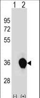 UNKL Antibody (aa1-30)