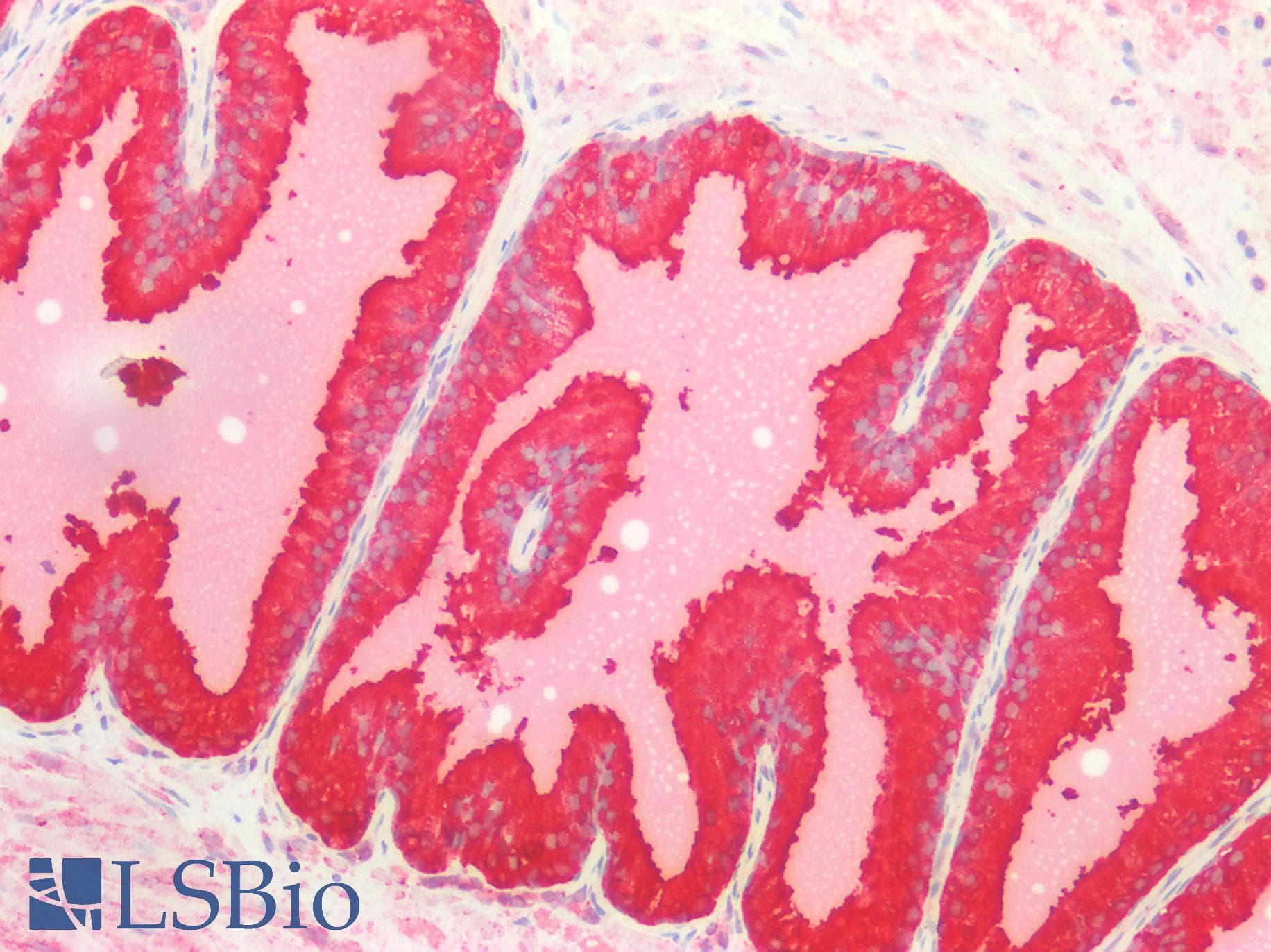 SLC27A1 / FATP Antibody (aa191-475)