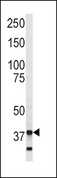 ANXA5 / Annexin V Antibody (aa262-291)