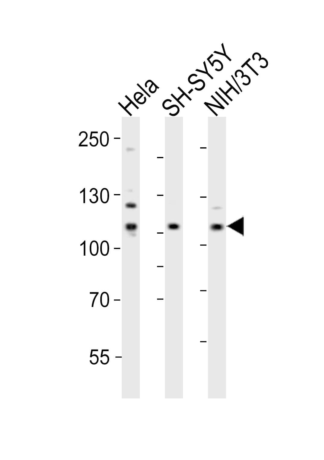 EPHB3 / EPH Receptor B3 Antibody (aa350-382)